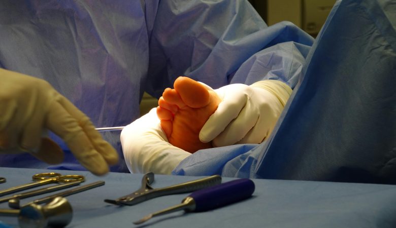 How Podiatry Services In UK Can Help in Walking Pain-Free?