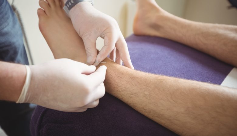 How to Remove Verrucas with Professional Treatment?