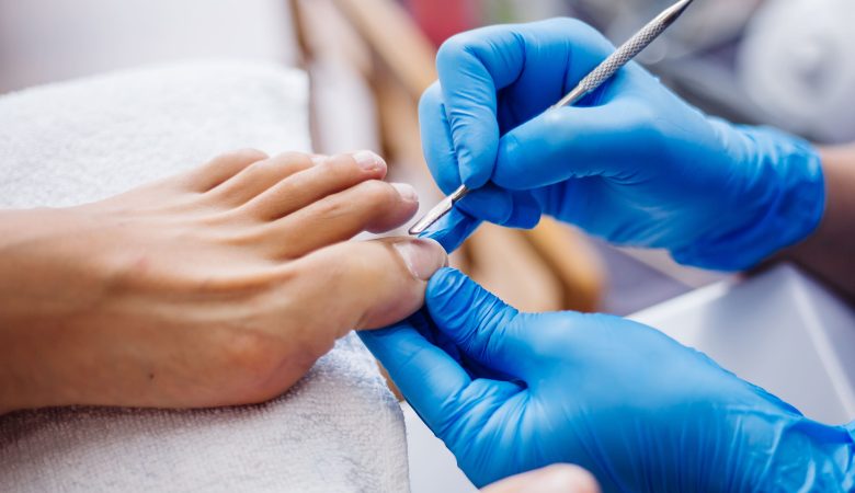 How Podiatrists Can Help In Treating Ingrown Toenails?